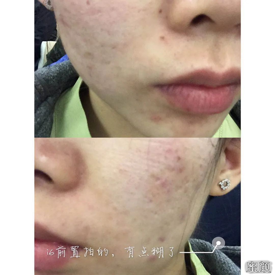 https://img.miyanlife.com/mnt/timg/200622/12411530M-4.jpg