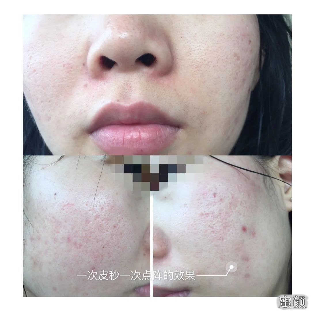 https://img.miyanlife.com/mnt/timg/200622/12411S0I-8.jpg
