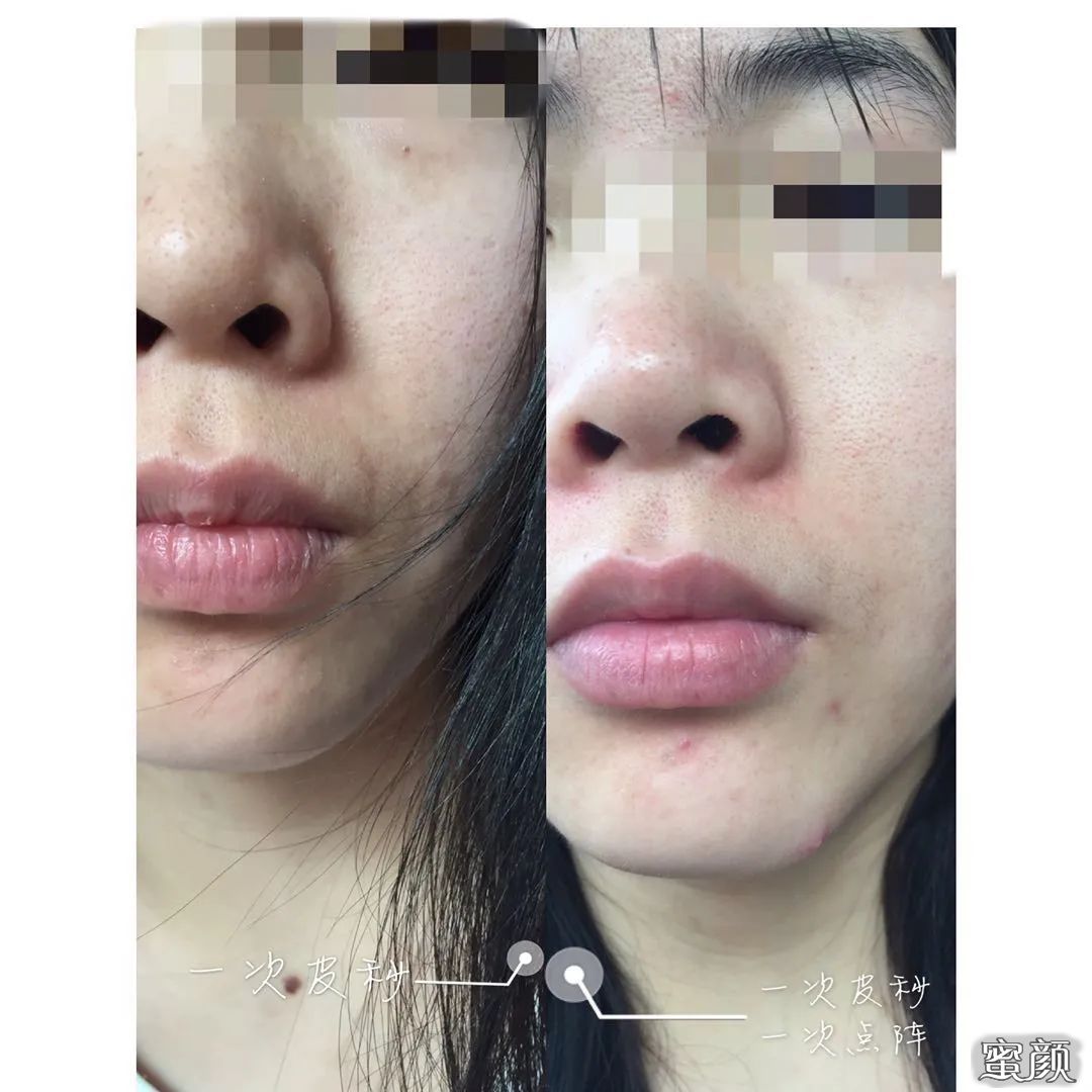 https://img.miyanlife.com/mnt/timg/200622/1241205496-9.jpg