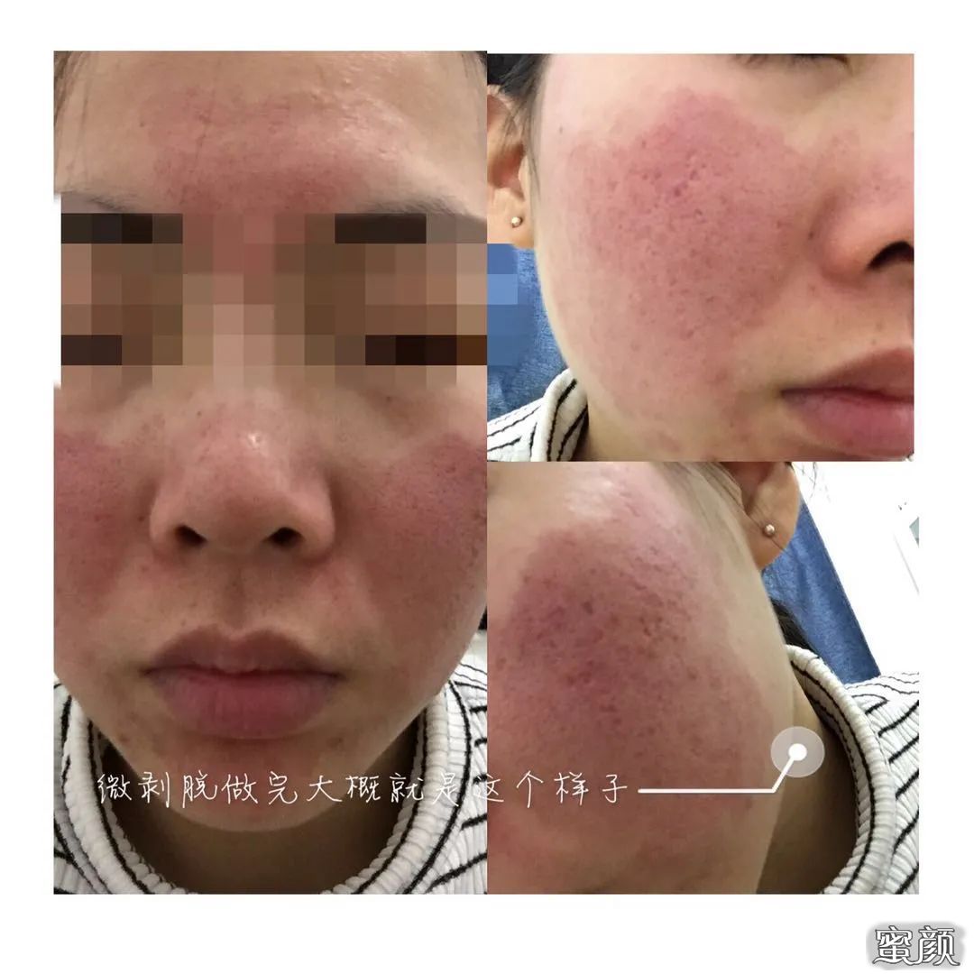 https://img.miyanlife.com/mnt/timg/200622/124122F45-11.jpg