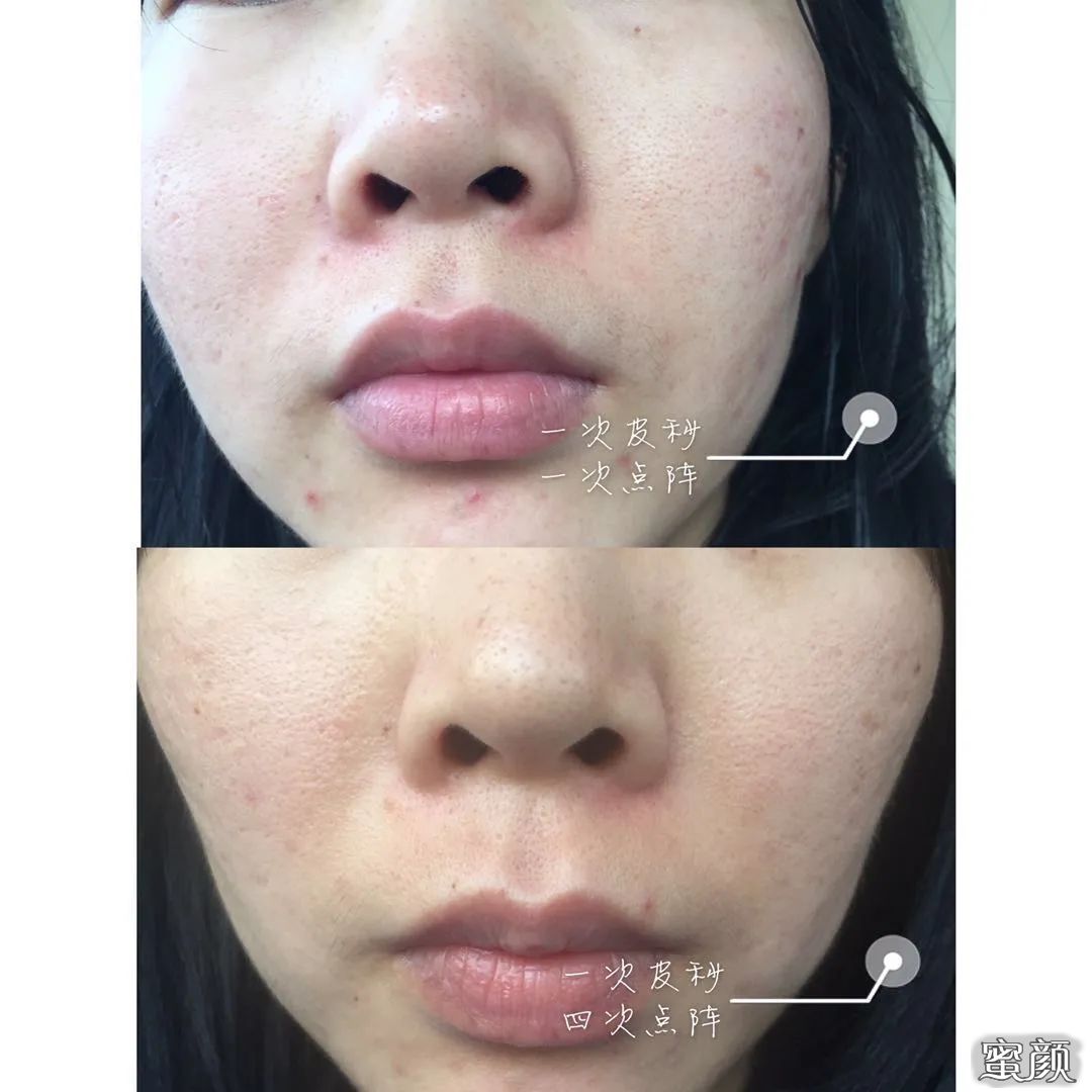 https://img.miyanlife.com/mnt/timg/200622/1241231Y7-12.jpg