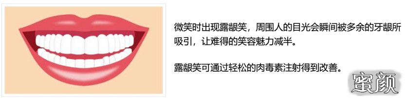 https://img.miyanlife.com/mnt/timg/200624/1041115360-0.jpg