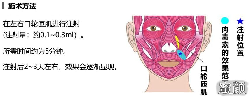 https://img.miyanlife.com/mnt/timg/200624/1041152339-2.jpg