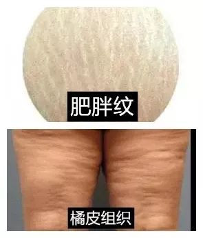 https://img.miyanlife.com/mnt/timg/200624/1112344144-8.jpg