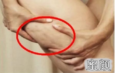 https://img.miyanlife.com/mnt/timg/200624/1112345596-7.jpg