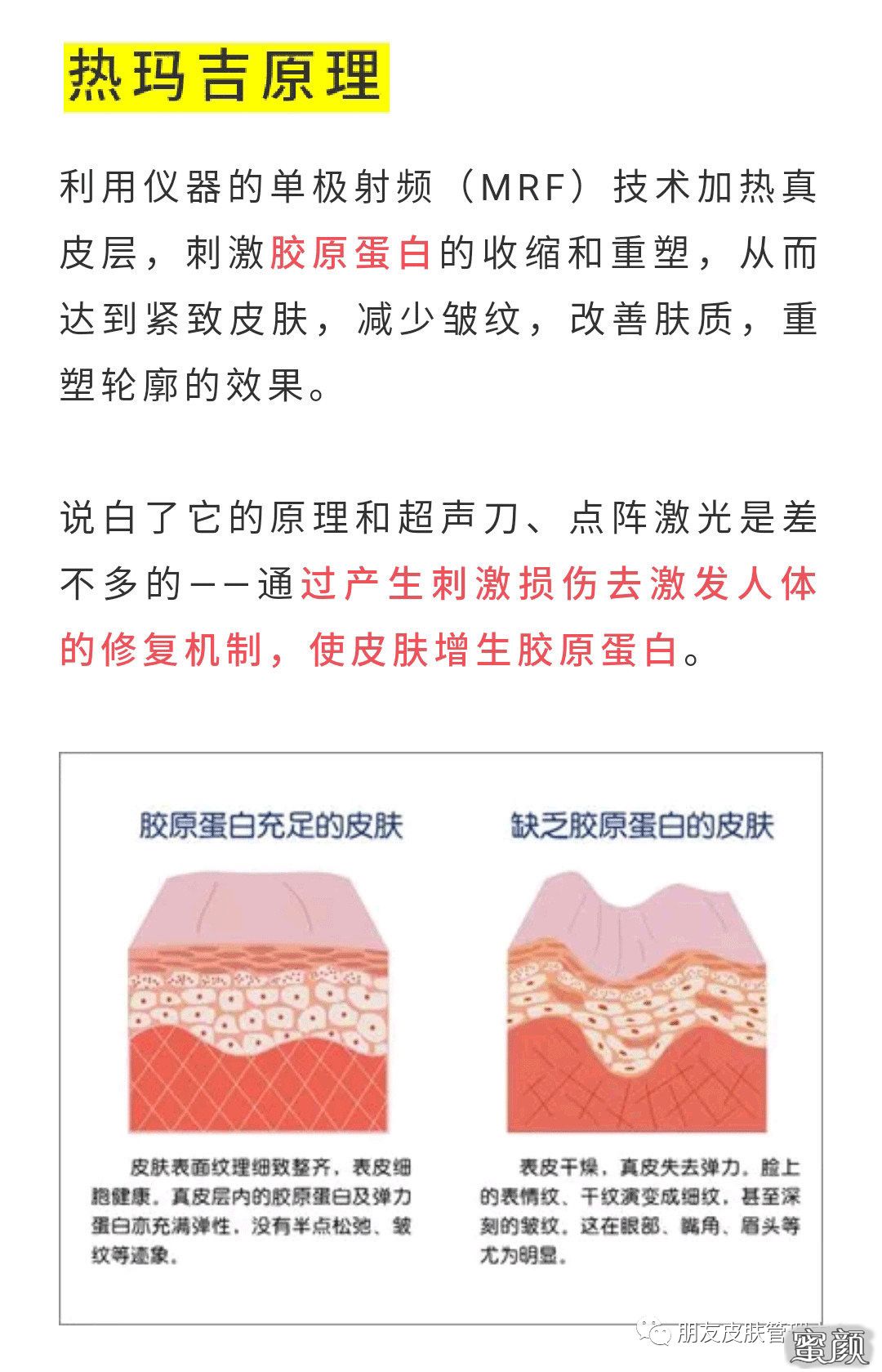 https://img.miyanlife.com/mnt/timg/200624/13043151H-0.jpg