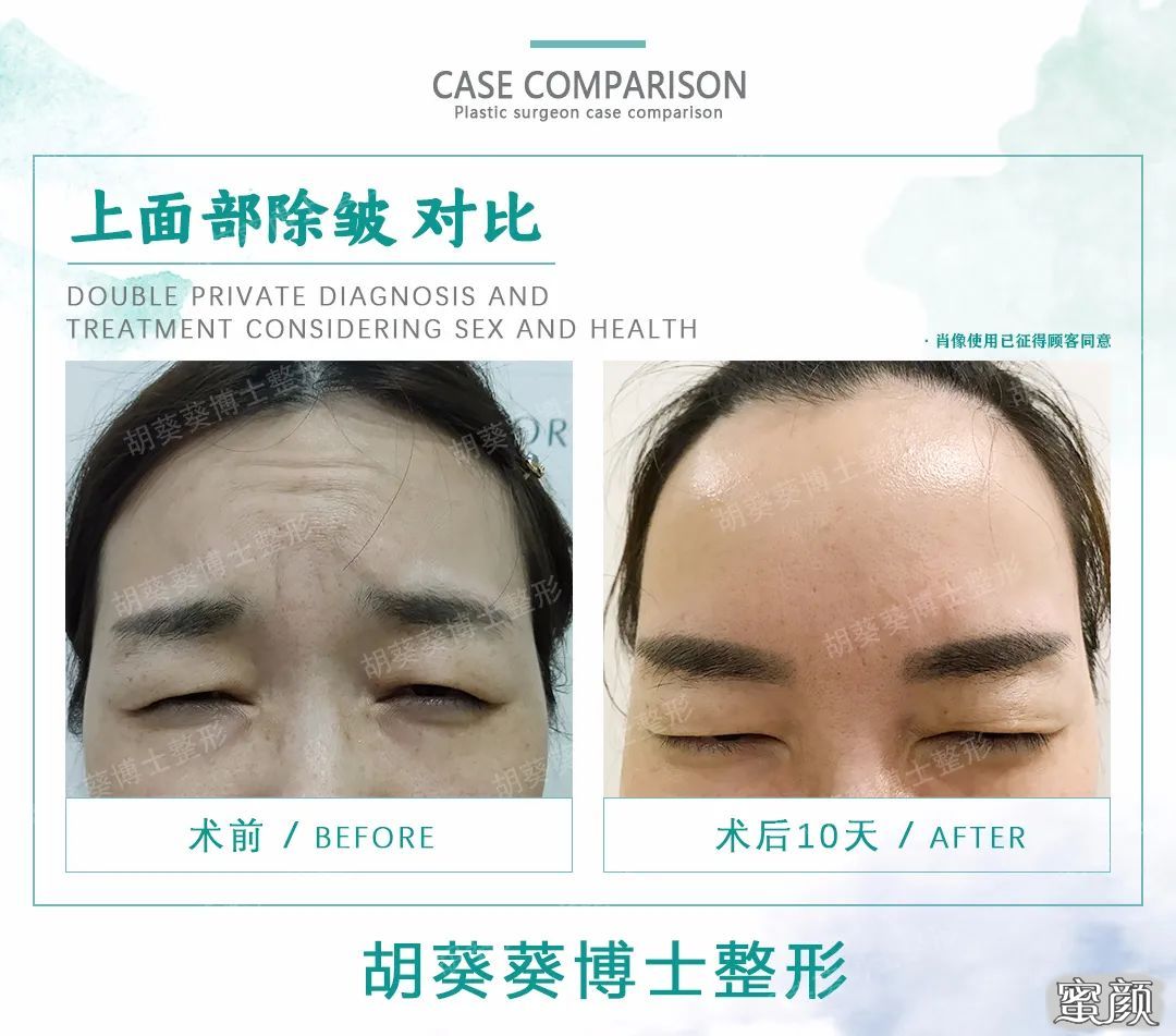 https://img.miyanlife.com/mnt/timg/200628/113P250D-2.jpg