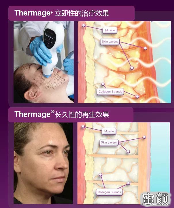 https://img.miyanlife.com/mnt/timg/200629/123042L32-6.jpg