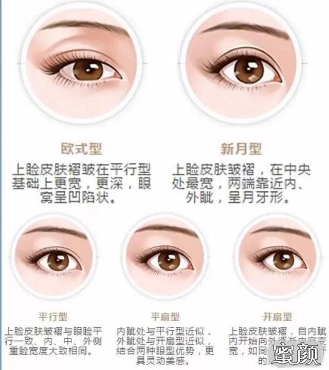 https://img.miyanlife.com/mnt/timg/200629/1343103414-4.jpg