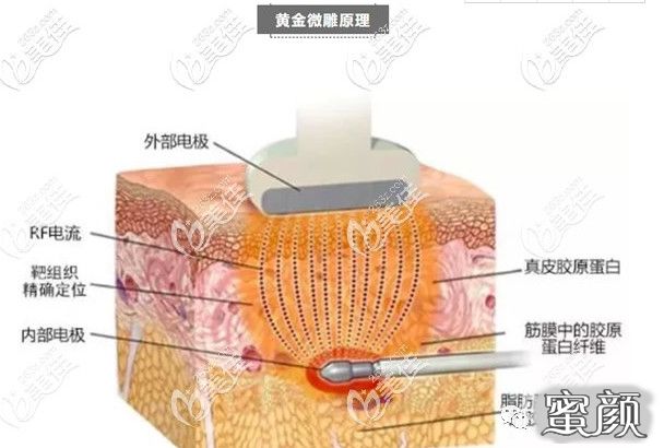 案例图片