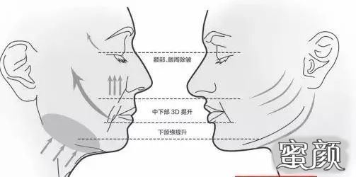 https://img.miyanlife.com/mnt/timg/200702/112445DW-3.jpg