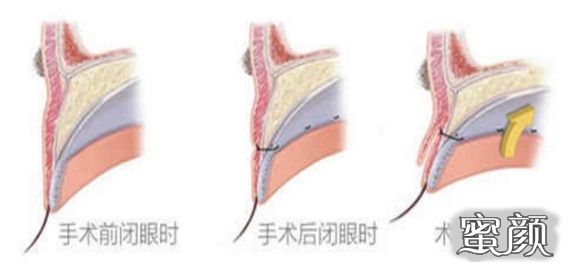 案例图片