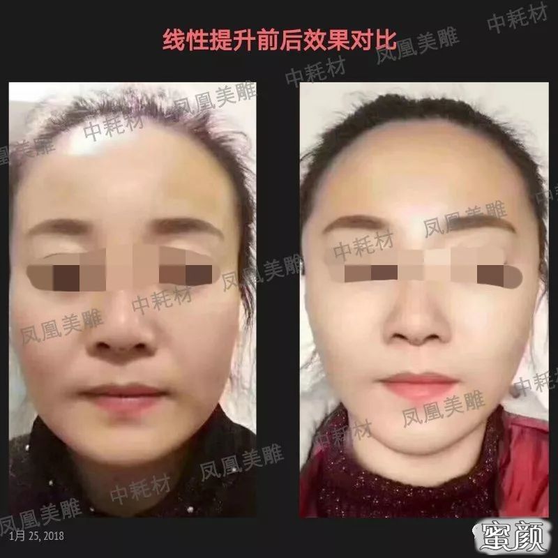 案例图片