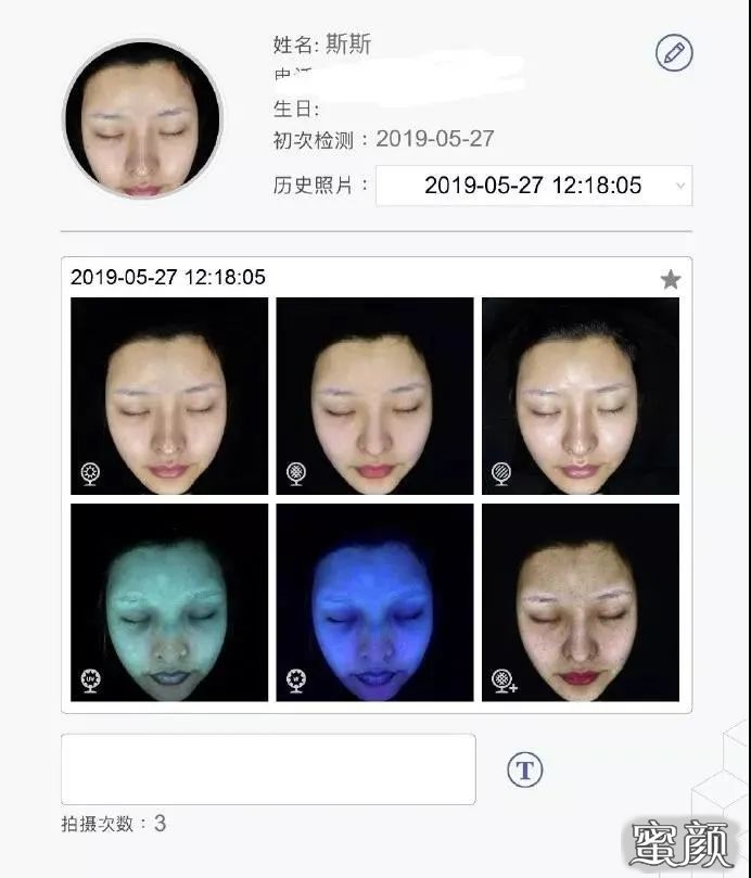 案例图片