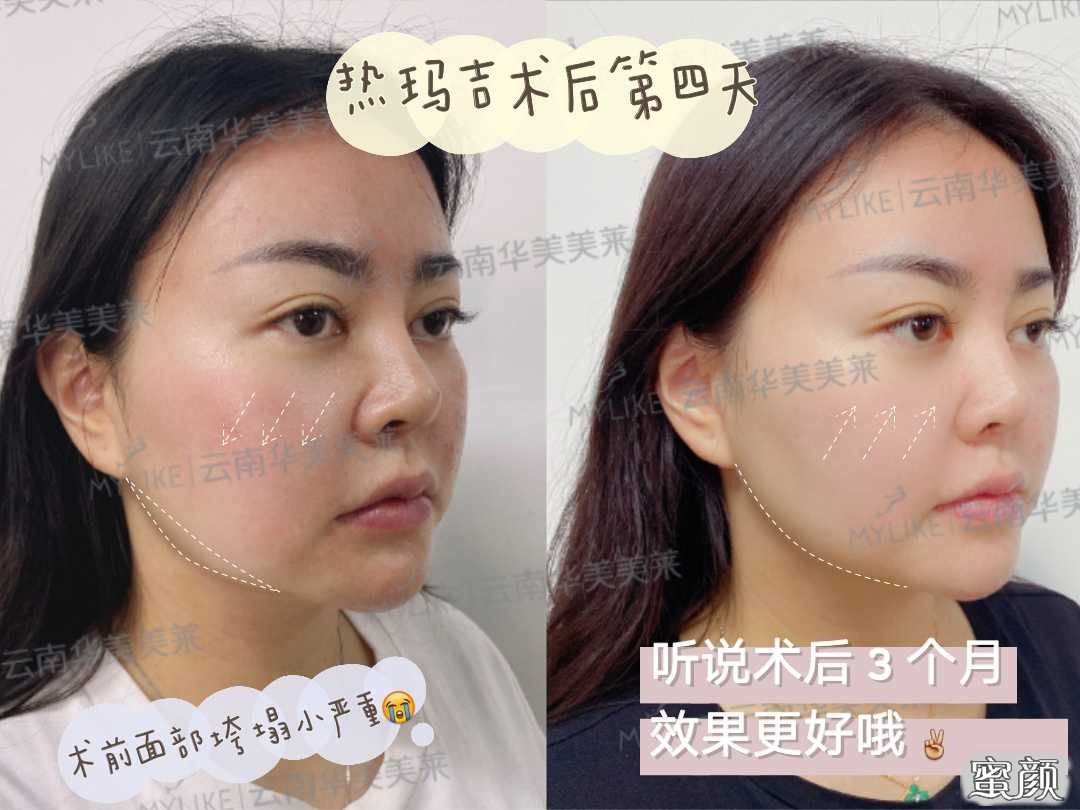 https://img.miyanlife.com/mnt/timg/200711/112G05b2-2.jpg