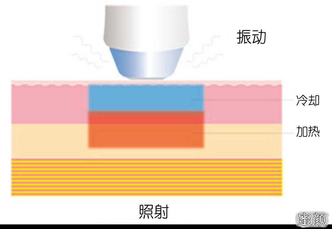 https://img.miyanlife.com/mnt/timg/200711/1136325N6-12.jpg