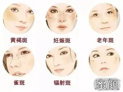 https://img.miyanlife.com/mnt/timg/200711/13045Vb1-0.jpg