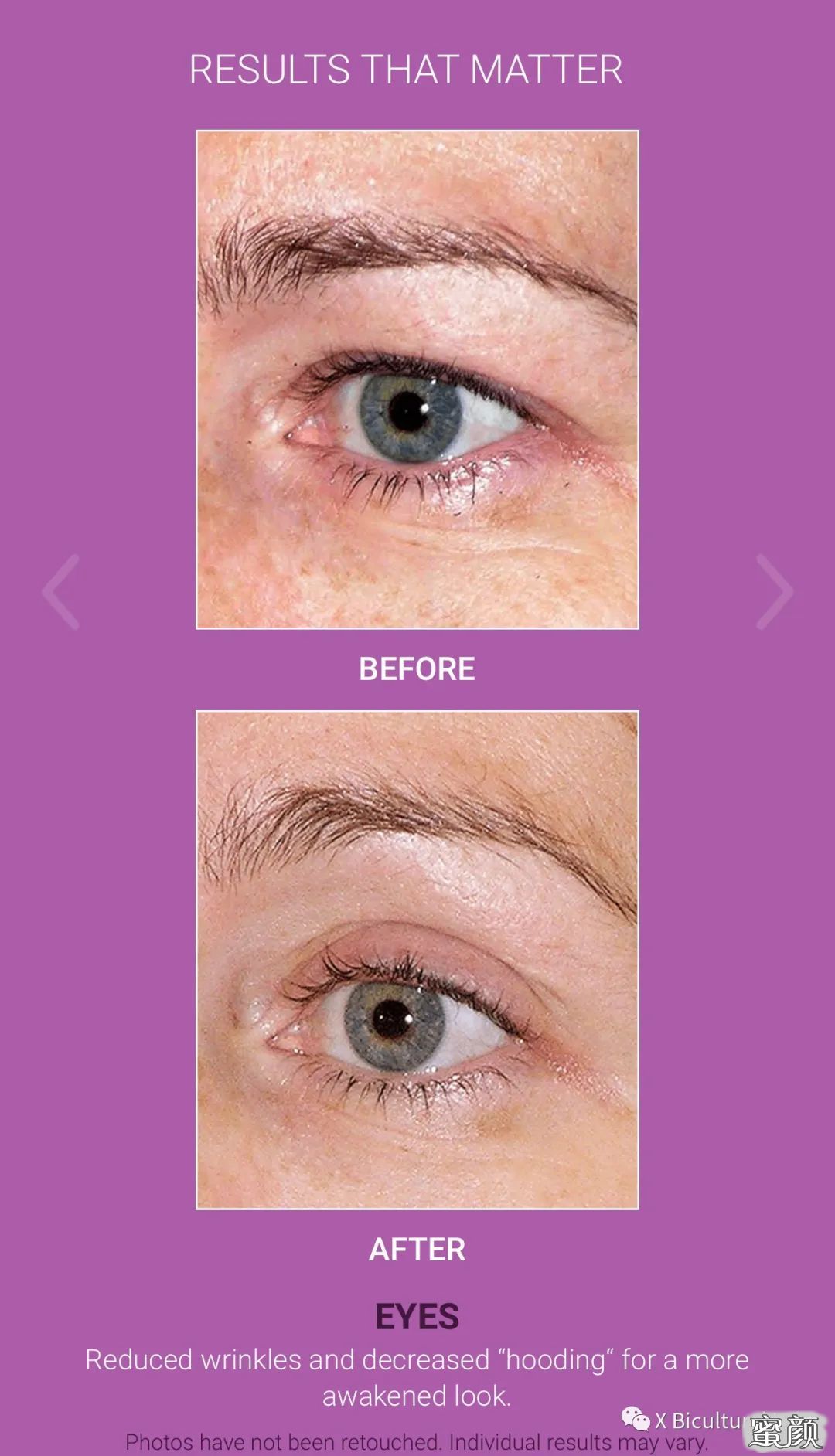 https://img.miyanlife.com/mnt/timg/200712/1016064548-1.jpg