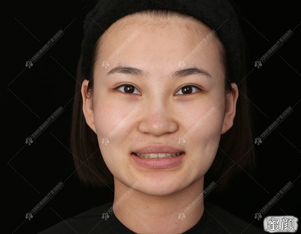 https://img.miyanlife.com/mnt/timg/200714/1254134556-1.jpg
