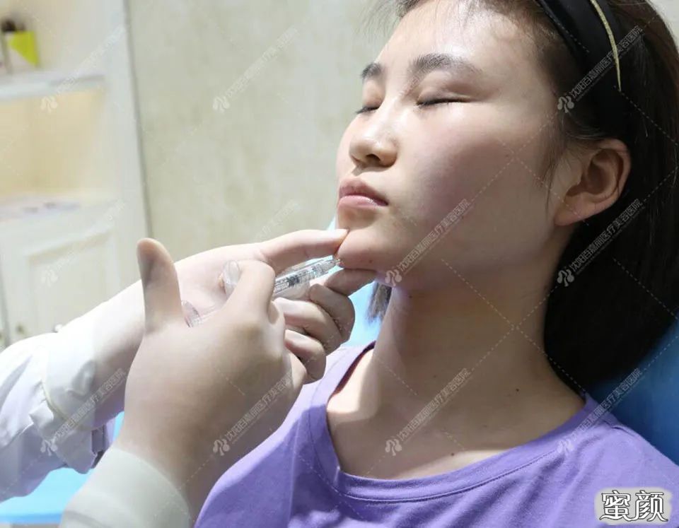 https://img.miyanlife.com/mnt/timg/200714/1254154G1-5.jpg