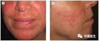 https://img.miyanlife.com/mnt/timg/200714/130IH5W-4.jpg