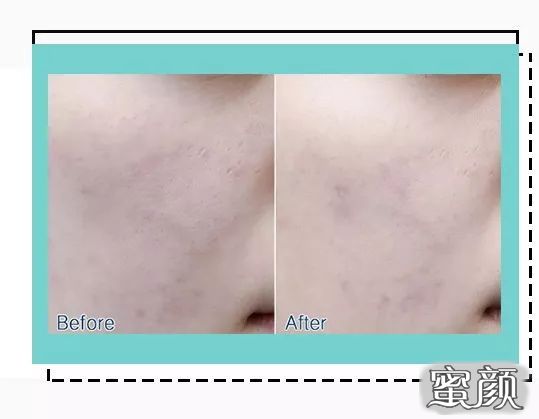 https://img.miyanlife.com/mnt/timg/200714/130Ia330-6.jpg