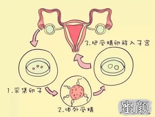 https://img.miyanlife.com/mnt/timg/200715/12315S2M-0.jpg