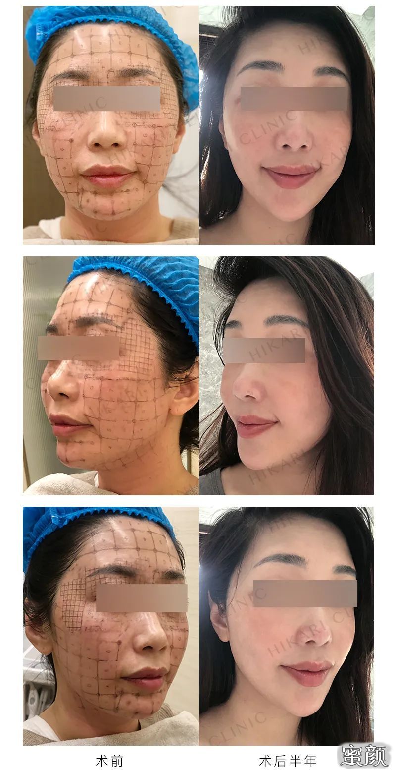 https://img.miyanlife.com/mnt/timg/200715/1320251614-4.jpg