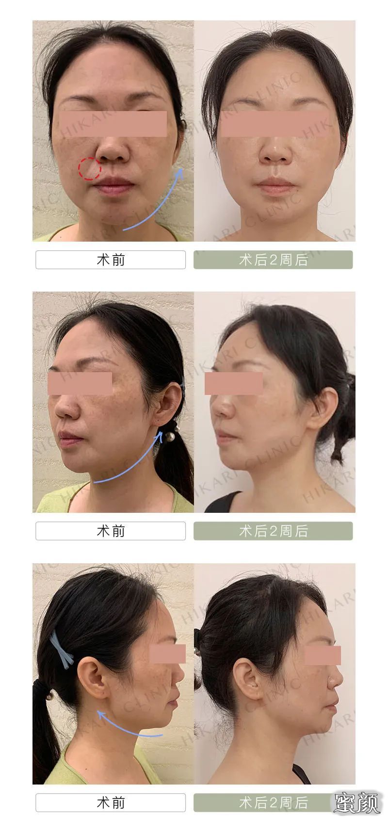 https://img.miyanlife.com/mnt/timg/200715/13202I041-5.jpg