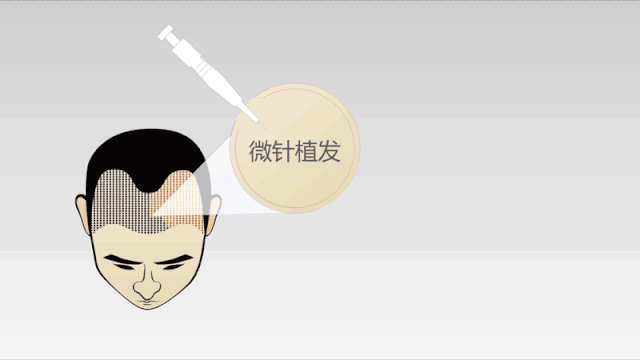 https://img.miyanlife.com/mnt/timg/200715/13505U018-3.gif