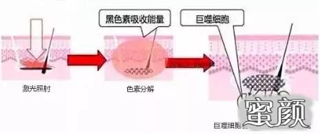 https://img.miyanlife.com/mnt/timg/200716/104Q125O-0.jpg