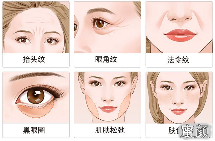 https://img.miyanlife.com/mnt/timg/200716/11054R358-0.jpg