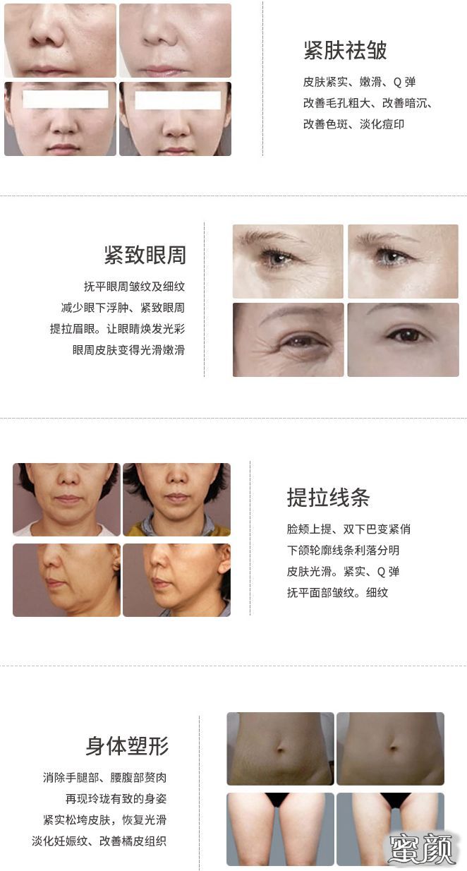 https://img.miyanlife.com/mnt/timg/200716/1105515S7-6.jpg