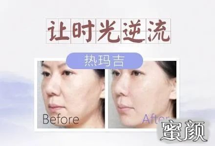 https://img.miyanlife.com/mnt/timg/200716/110R15L0-0.jpg