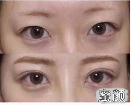 https://img.miyanlife.com/mnt/timg/200716/1231124136-1.jpg