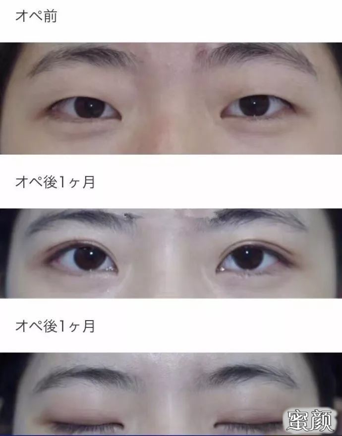 https://img.miyanlife.com/mnt/timg/200716/1231124U2-2.jpg