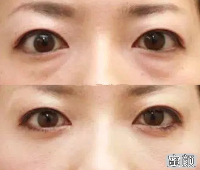 https://img.miyanlife.com/mnt/timg/200716/1231144c0-7.jpg