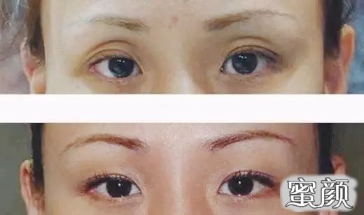 https://img.miyanlife.com/mnt/timg/200716/123114BA-5.jpg
