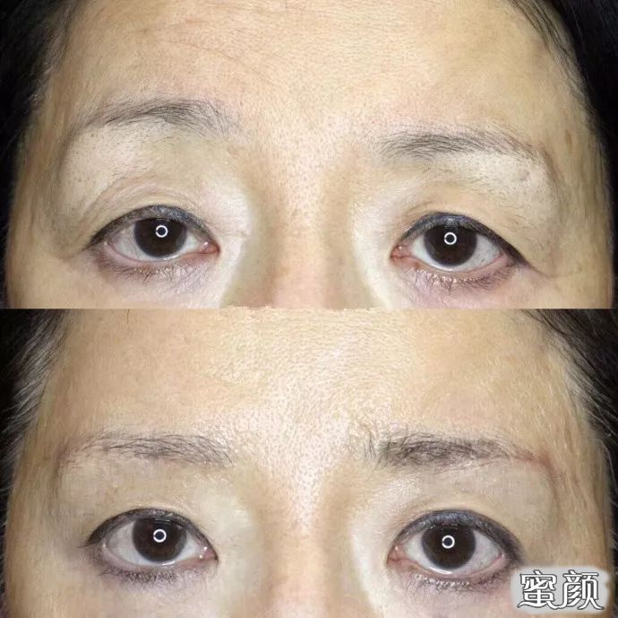 https://img.miyanlife.com/mnt/timg/200716/123115I37-8.jpg