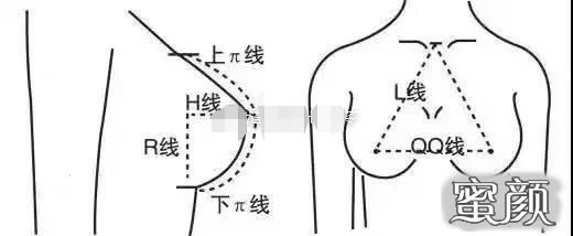 案例图片