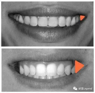https://img.miyanlife.com/mnt/timg/200717/112I92S8-17.jpg