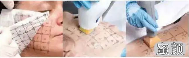 https://img.miyanlife.com/mnt/timg/200717/12014H254-2.jpg