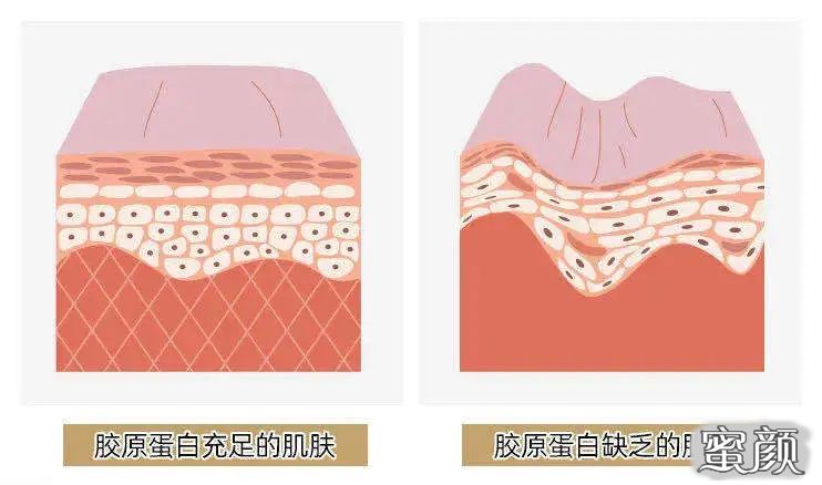 https://img.miyanlife.com/mnt/timg/200718/1430013J4-6.jpg