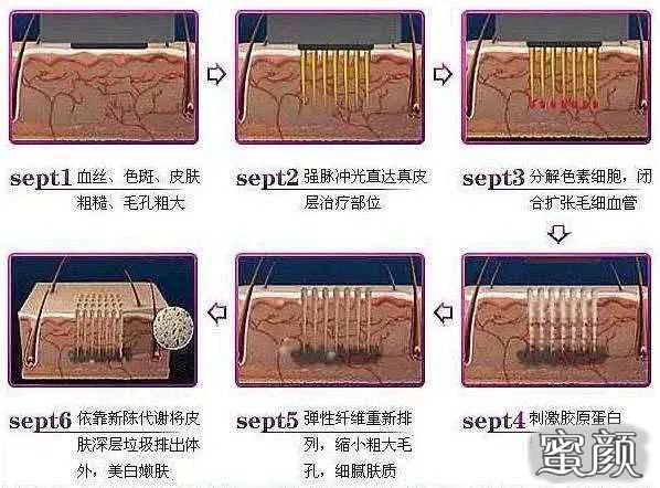 案例图片