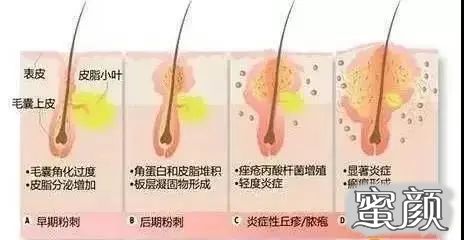 https://img.miyanlife.com/mnt/timg/200719/14163424W-4.jpg