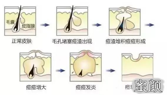 https://img.miyanlife.com/mnt/timg/200719/141635I40-6.jpg