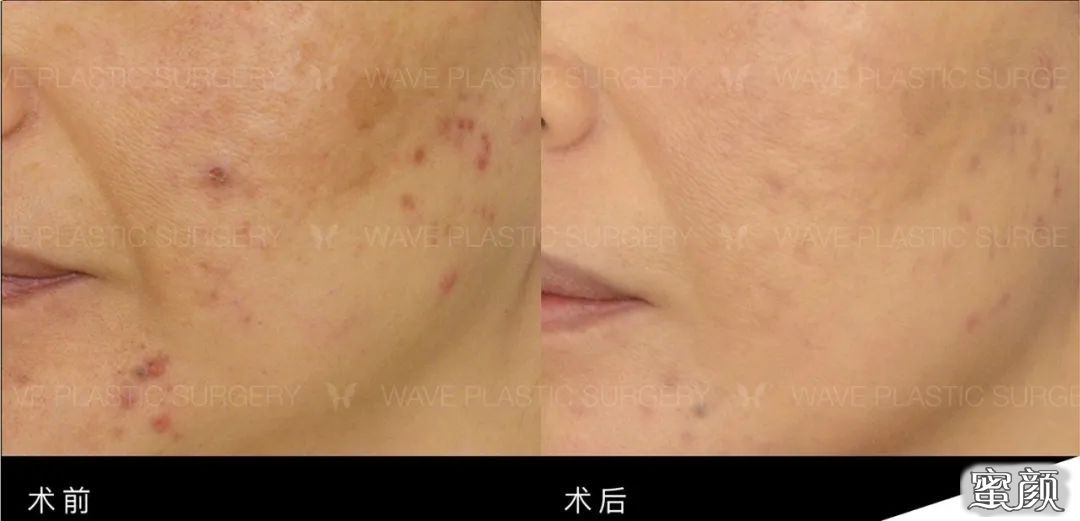 https://img.miyanlife.com/mnt/timg/200719/141F23054-14.jpg