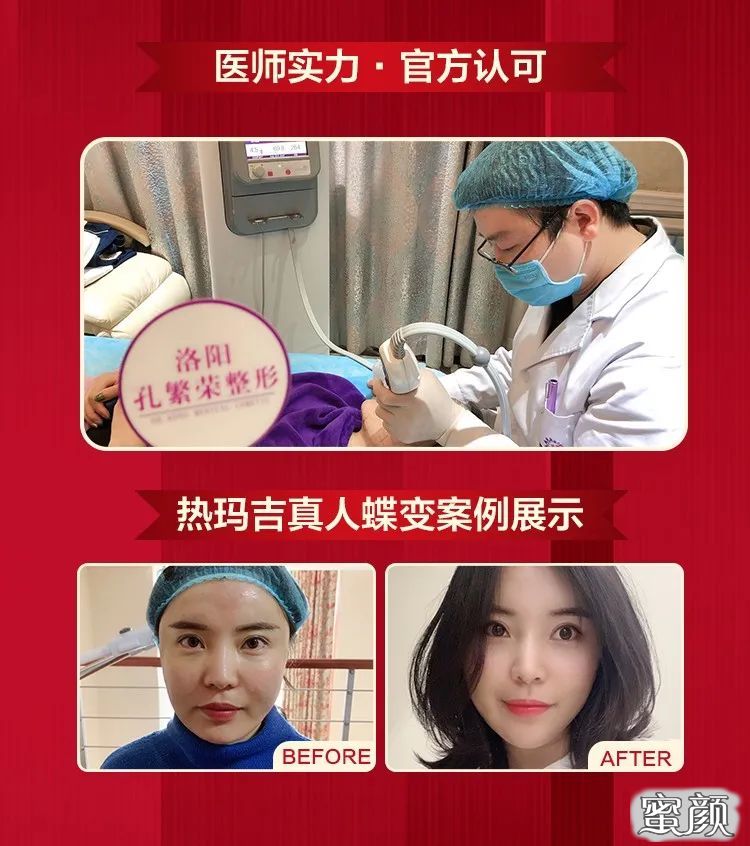 https://img.miyanlife.com/mnt/timg/200720/12005113a-4.jpg