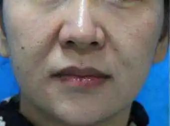 https://img.miyanlife.com/mnt/timg/200720/1202216311-1.jpg