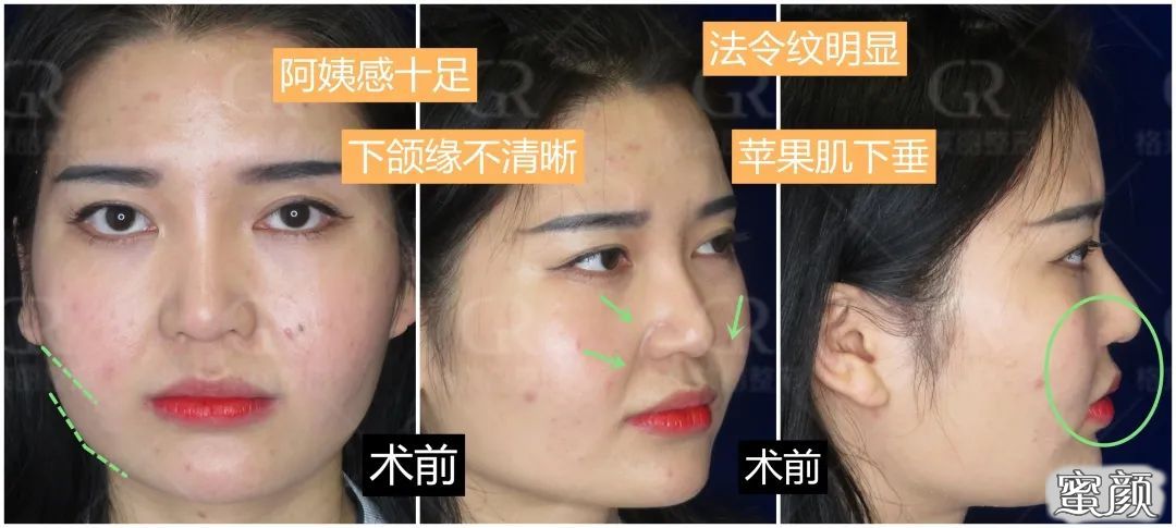 https://img.miyanlife.com/mnt/timg/200720/1202534601-9.jpg